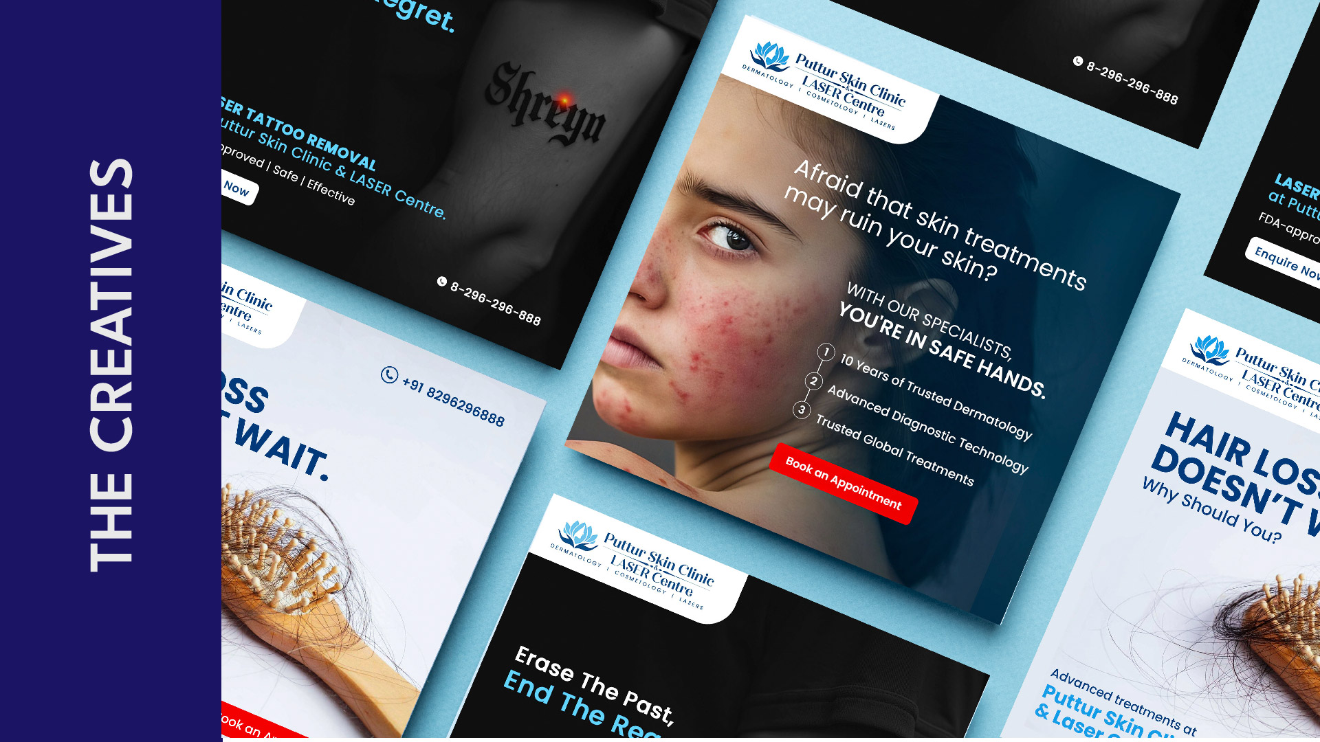 Case study puttur skin clinic 05